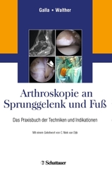 Arthroskopie an Sprunggelenk und Fu&szlig;