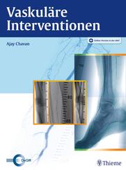 Vaskul&auml;re Interventionen