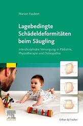 Lagebedingte Sch&auml;deldeformit&auml;ten beim S&auml;ugling