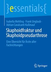 Skaphoidfraktur und Skaphoidpseudarthrose