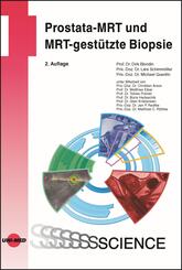 Prostata-MRT und MRT-gest&uuml;tzte Biopsie