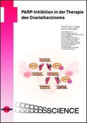 PARP-Inhibition in der Therapie des Ovarialkarzinoms