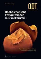 Hoch&auml;sthetische Restaurationen aus Vollkeramik