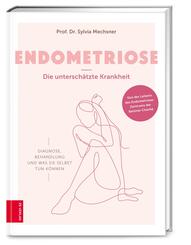 Endometriose - Die untersch&auml;tzte Krankheit